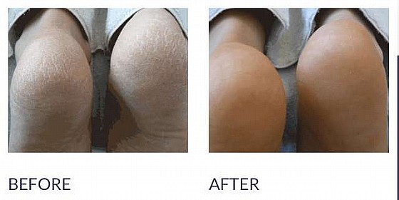 ��������� ��� ������ ������ ������ ���� 3 FootLogix ���� 300 �"�