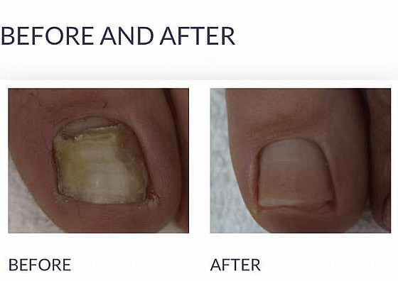 ��������� ����� ������ ����� ��������� ���� 7T ������ �� ������ ���������� FootLogix ���� 50 �"�